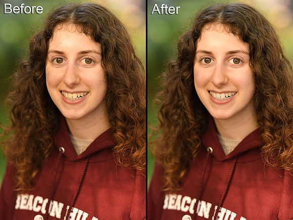Before and After