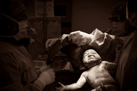 Birth
